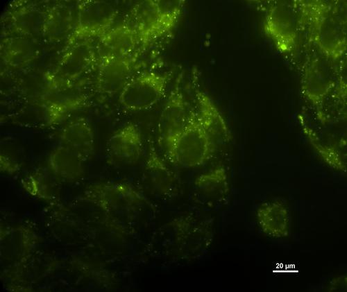 Fluorescence na HeLa buňkách